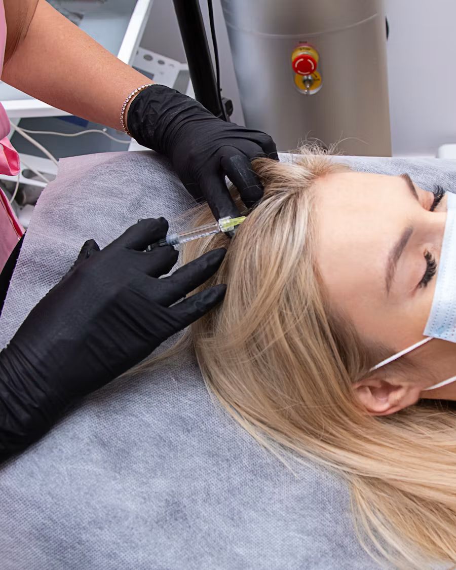 Platelet-rich plasma being injected into the scalp along a hair parting