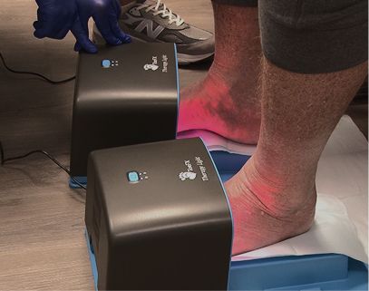 A client's feet under two ToeFX therapy light units